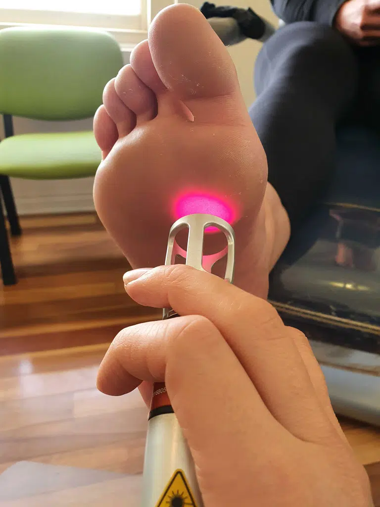 Laser Therapy Treatment